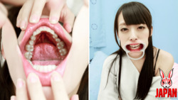 Ikumi Kuroki's Vulnerable Revelation: A Journey into Dental Sensitivities and Unveiled Imperfections