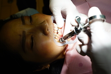 Dental Treatment ; Amateur Girl MAKOTO (2nd Time)