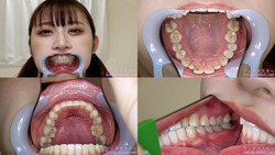 【치아 페티쉬】미즈하라 미소의 치아를 관찰했습니다!