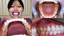 [Tooth fetish] I observed Yuno Kisaragi&#39;s teeth!