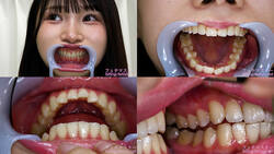 【치아 페티쉬】유라카나의 치아를 관찰했습니다!